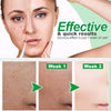 Image of Buy 4 Free Shipping & 20% More OFF-Zero Pore Instant Perfection Serum - Threads and Metal