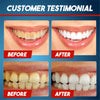 Image of 【Last Day 50% Promotion】 - Intensive Stain Removal Whitening Toothpaste