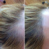 Image of Scalp Intense Roll-on 7 Days Hair Regrowth Serum (2020 New Version)