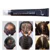 Image of Scalp Intense Roll-on 7 Days Hair Regrowth Serum (2020 New Version)