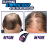 Image of Hair Growing And Re-Activating Roller