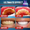Image of 【Last Day 50% Promotion】 - Intensive Stain Removal Whitening Toothpaste