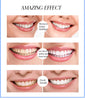 Image of Flawless Teeth Whitening Pen